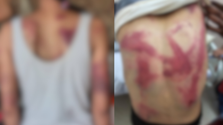 बीडमध्ये गुन्हेगारीचा कळस! महिला वकिलाला सरपंच आणि कार्यकर्त्यांकडून पाईपने अमानुष मारहाण